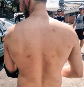 how bad does paintball hurt