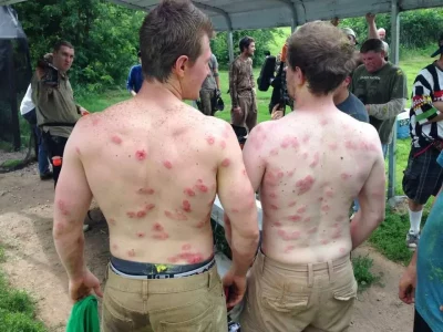 2 men with paintball welts on backs